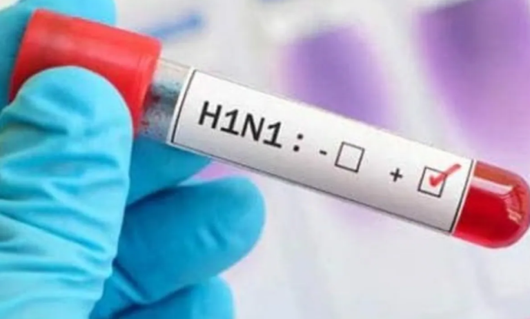 Swine Flu CG